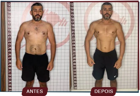 Antes e depois de paciente com evolução de composição corporal na Clínica Motivation